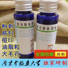 中藥?kù)疃划a(chǎn)品前五強(qiáng) 科學(xué)祛痘，收細(xì)毛孔，告別粉刺痤瘡